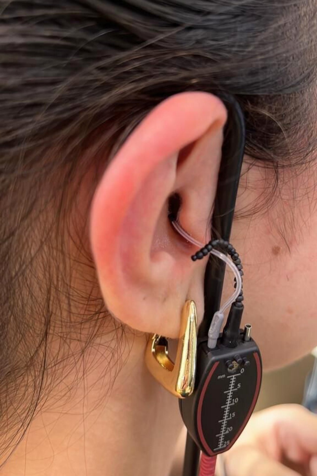 O mapeamento de fala otimiza a configuração dos aparelhos auditivos, garantindo clareza e conforto na comunicação. Agende sua Visita!